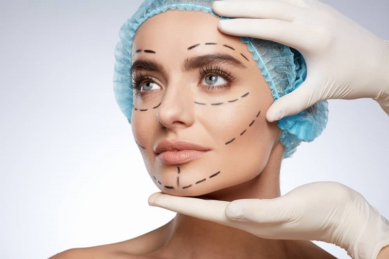 Plastic-Surgery
