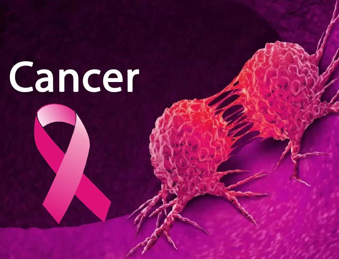 Best Cancer Doctor In Harda