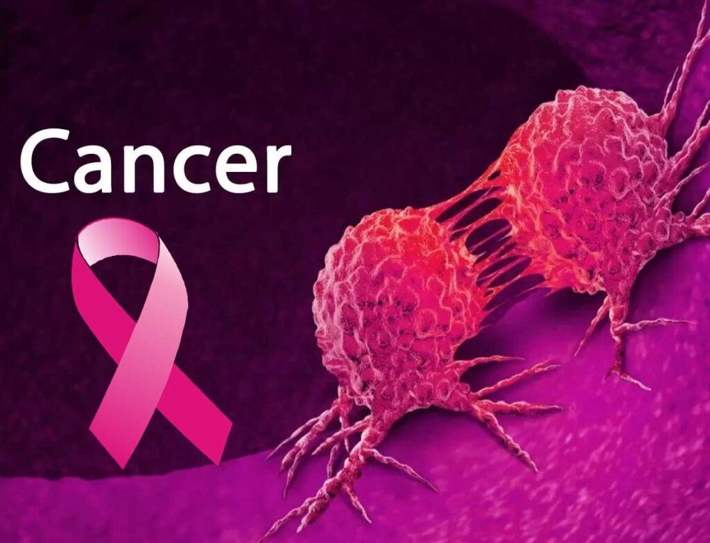 Best Cancer Doctor In Sagar | Columbia Hospital
