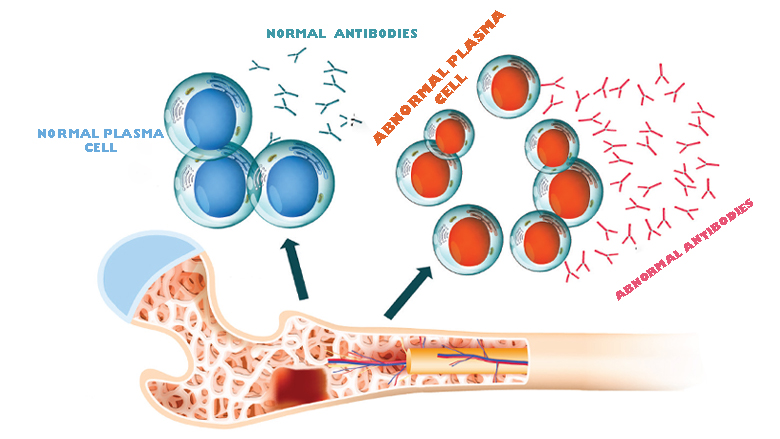 Blood Cancer Treatment In satna