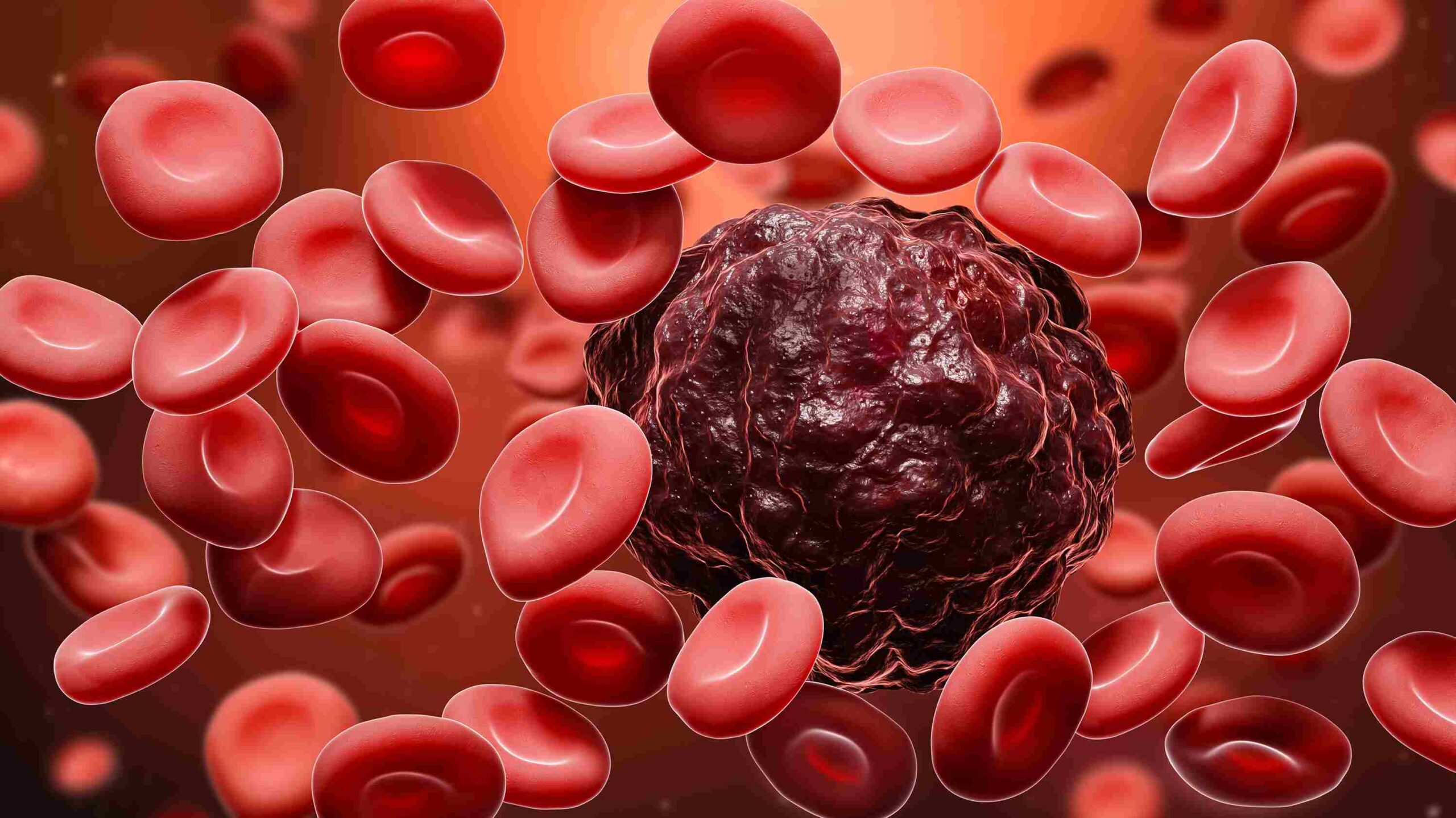 Blood Cancer treatment In Katni